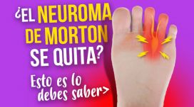 consejo sobre neuroma de morton